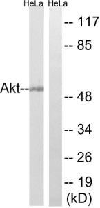 Western blot analysis of lysates from HeLa cells using Anti-Akt Antibody The right hand lane represents a negative control, where the antibody is blocked by the immunising peptide