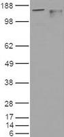 Anti-CDKN2A Rabbit Polyclonal Antibody