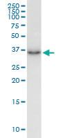 Anti-HTRA3 Mouse Monoclonal Antibody [clone: 1F2]