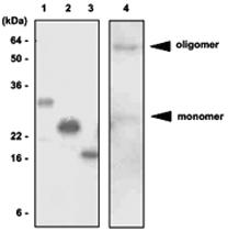 Anti-ADIPOQ Mouse Monoclonal Antibody [clone: 1G12]