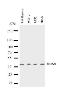 Anti-p53R2 Rabbit Polyclonal Antibody