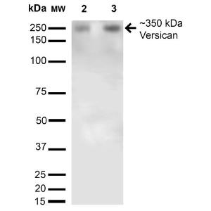 Western blot analysis of rat brain membrane and brain showing detection of 350kDa Versican protein using Anti-Versican Antibody [S351-23] (A305042) at 1:200 for 16 hours at 4°C