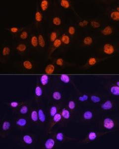 Immunofluorescence analysis of C6 cells using Anti-Arx Antibody (A92983) at a dilution of 1:100. DAPI was used to stain the cell nuclei (blue)