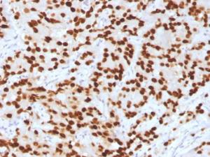 Immunohistochemical analysis of formalin-fixed, paraffin-embedded human prostate using Anti-FOXA1 Antibody [FOXA1/1516]