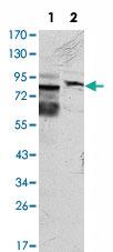 Anti-KLHL11 Mouse Monoclonal Antibody [clone: 1B9C1]