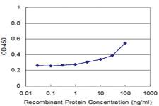 Anti-UGT2B4 Mouse Monoclonal Antibody [clone: 2H6]