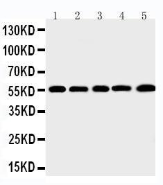 Anti-MMP12 Rabbit Polyclonal Antibody