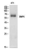 Anti-BMP6 antibody