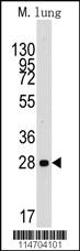 Anti-CCND1 Rabbit Polyclonal Antibody