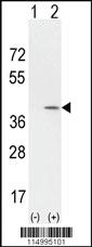 Anti-CCND1 Rabbit Polyclonal Antibody