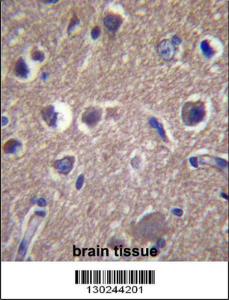 Anti-ANKS1B Rabbit Polyclonal Antibody (Biotin)