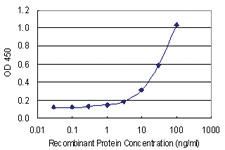 Anti-HTRA3 Mouse Monoclonal Antibody [clone: 1F2]