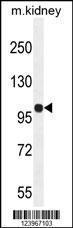 Anti-KIAA1324L Rabbit Polyclonal Antibody (AP (Alkaline Phosphatase))