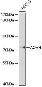 Western blot analysis of extracts of BxPC-3 cells, using Anti-Acyloxyacyl Hydrolase Antibody (A8597) at 1:1,000 dilution