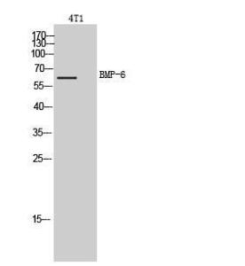 Anti-BMP6 antibody