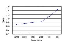 Anti-AXL Antibody Pair