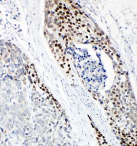 Anti-p63 Rabbit Polyclonal Antibody