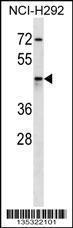 Anti-AKR1C4 Rabbit Polyclonal Antibody (FITC (Fluorescein Isothiocyanate))