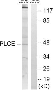 Western blot analysis of lysates from LOVO cells using Anti-AGPAT5 Antibody. The right hand lane represents a negative control, where the antibody is blocked by the immunising peptide.