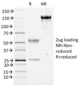 SDS-PAGE analysis of Anti-FOXA1 Antibody [FOXA1/1516] under non-reduced and reduced conditions; showing intact IgG and intact heavy and light chains, respectively. SDS-PAGE analysis confirms the integrity and purity of the antibody