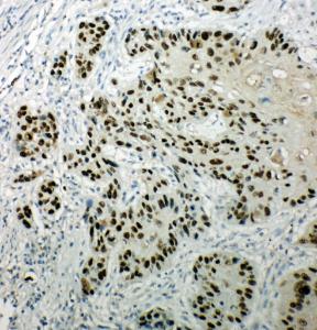 Anti-p63 Rabbit Polyclonal Antibody