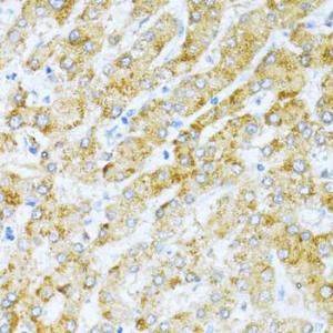 Anti-KLHL42 Rabbit Polyclonal Antibody