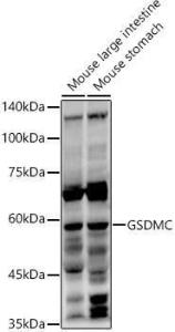 Western blot analysis of extracts of various cell lines, using Anti-GSDMC Antibody (A92984) at 1:1,000 dilution