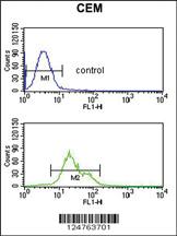 Anti-S39A8 Rabbit Polyclonal Antibody