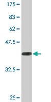 Anti-PSMB8 Mouse Monoclonal Antibody [clone: 4E4]