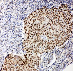 Anti-p63 Rabbit Polyclonal Antibody