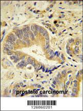 Anti-IDUA Rabbit Polyclonal Antibody (FITC (Fluorescein Isothiocyanate))