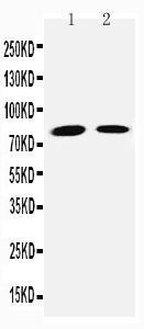 Anti-Transglutaminase 2 Rabbit Polyclonal Antibody