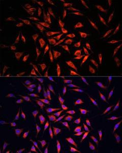 Immunofluorescence analysis of L929 cells using Anti-GSDMC Antibody (A92984) at a dilution of 1:100. DAPI was used to stain the cell nuclei (blue)