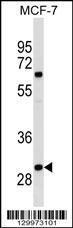 Anti-OR4M2 Rabbit Polyclonal Antibody (FITC (Fluorescein Isothiocyanate))