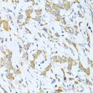 Anti-KLHL42 Rabbit Polyclonal Antibody