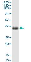 Anti-SLC14A1 Polyclonal Antibody Pair