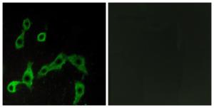 Immunofluorescence analysis of LOVO cells using Anti-ADRA2A Antibody. The right hand panel represents a negative control, where the Antibody was pre-incubated with the immunising peptide