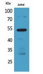 Western blot analysis of Jurkat cells using Anti-BMP3 Antibody