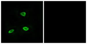 Immunofluorescence analysis of LOVO cells using Anti-OR52N1 Antibody. The right hand panel represents a negative control, where the antibody was pre-incubated with the immunising peptide