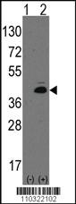 Anti-ATOH1 Rabbit Polyclonal Antibody