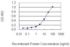 Anti-TRPC1 Mouse Monoclonal Antibody [clone: 1E4]