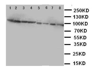 Anti-Factor VIII Rabbit Polyclonal Antibody