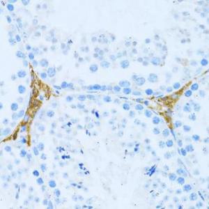 Anti-KLHL42 Rabbit Polyclonal Antibody