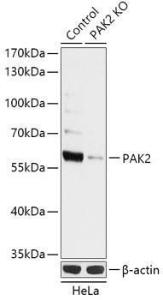 Western blot analysis of extracts from normal (control) and PAK2 knockout (KO) HeLa cells, using Anti-PAK2 Antibody (A92985) at 1:1,000 dilution The secondary antibody was Goat Anti-Rabbit IgG H&L Antibody (HRP) at 1:10,000 dilution Lysates/proteins were present at 25 µg per lane