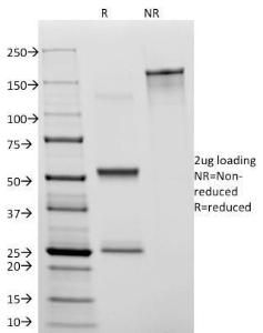 SDS-PAGE analysis of Anti-CD31 Antibody [C31.3] under non-reduced and reduced conditions; showing intact IgG and intact heavy and light chains, respectively. SDS-PAGE analysis confirms the integrity and purity of the antibody