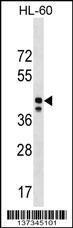 Anti-MRPS31 Rabbit Polyclonal Antibody