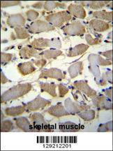 Anti-MSS51 Rabbit Polyclonal Antibody (AP (Alkaline Phosphatase))