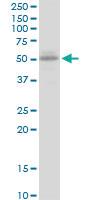 Anti-UGT2B15 Mouse Polyclonal Antibody