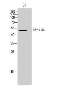 Western blot analysis of JK cells using Anti-ADRA2A Antibody