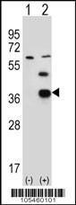 Anti-PDXK Rabbit Polyclonal Antibody (Biotin)